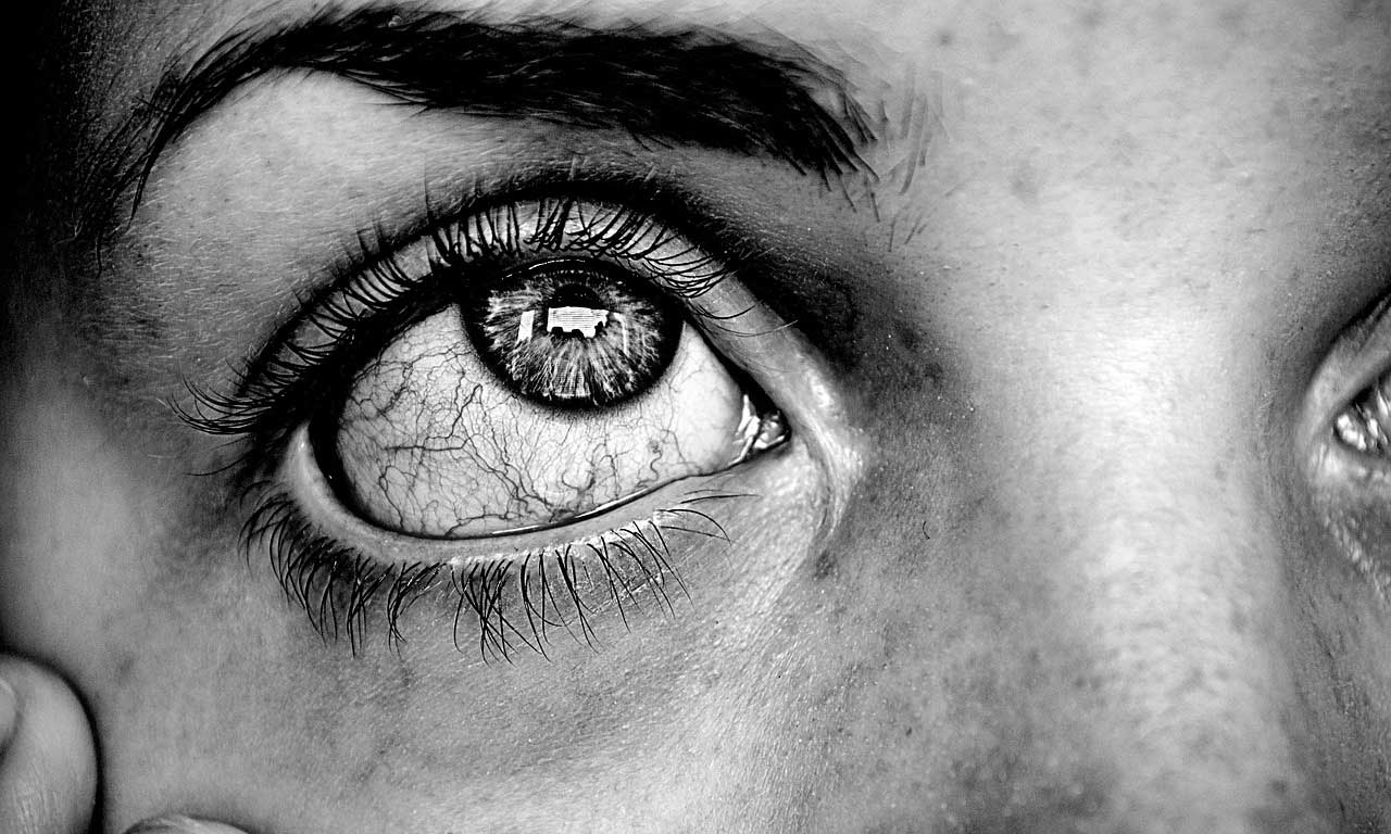 inflamed eye image